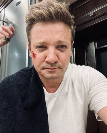 ▲「鷹眼」傑瑞米雷納在家意外受傷，情況一度危急。（圖／翻攝自Instagram／Jeremy Renner）