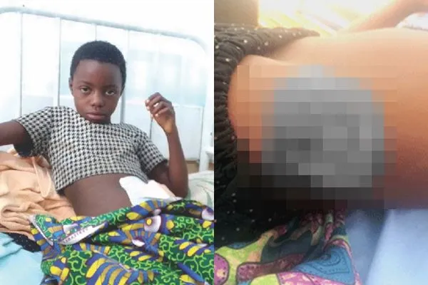 ▲▼來自納米比亞的海克拉（Regimiya Haikera）遭鱷魚攻擊。（圖／翻攝自The New Era、The Namibian）