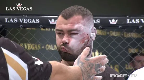 ▲▼羅馬尼亞日前舉辦「RXF搧巴掌比賽」（RXF Slap Fighting），參賽選手科薩（Sorin Comsa）被打到臉腫濺血、面目全非。（圖／翻攝自YouTube／RXF）