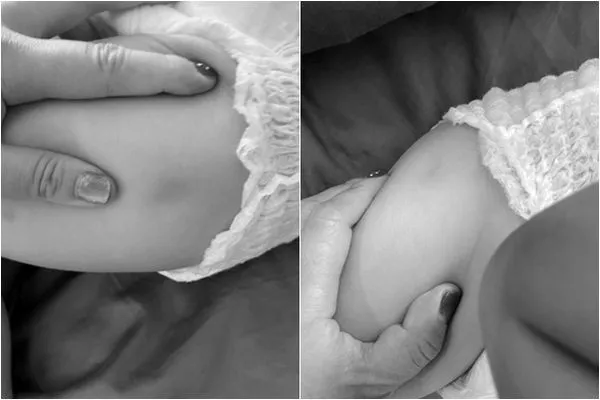 ▲▼男童送往台北市某托兒所，遭園長毆打生殖器、屁股。（圖／翻攝PTT）