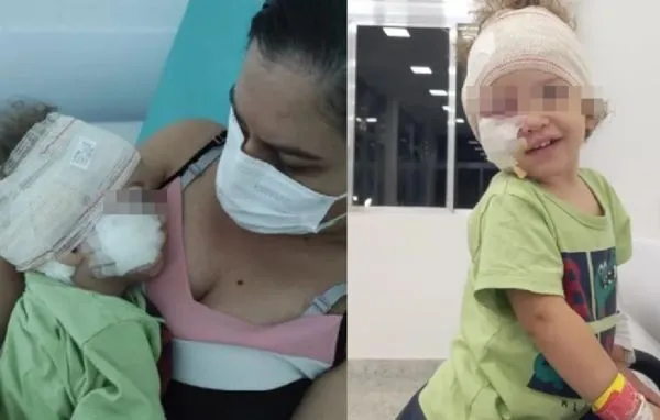 送保母家才5分鐘！寵物犬突然飛撲男童　「臉被咬爛」扯下部分耳。（圖／翻攝自Twitter）