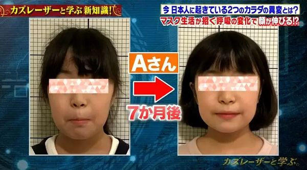 ▲▼日本牙醫師警告用嘴巴呼吸恐影響臉型。（圖／翻攝自推特）