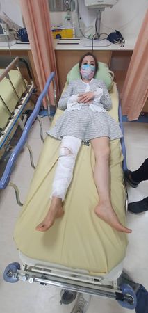▲許聖梅1月摔傷腿，目前還未完全痊癒。（圖／翻攝自臉書／許聖梅）