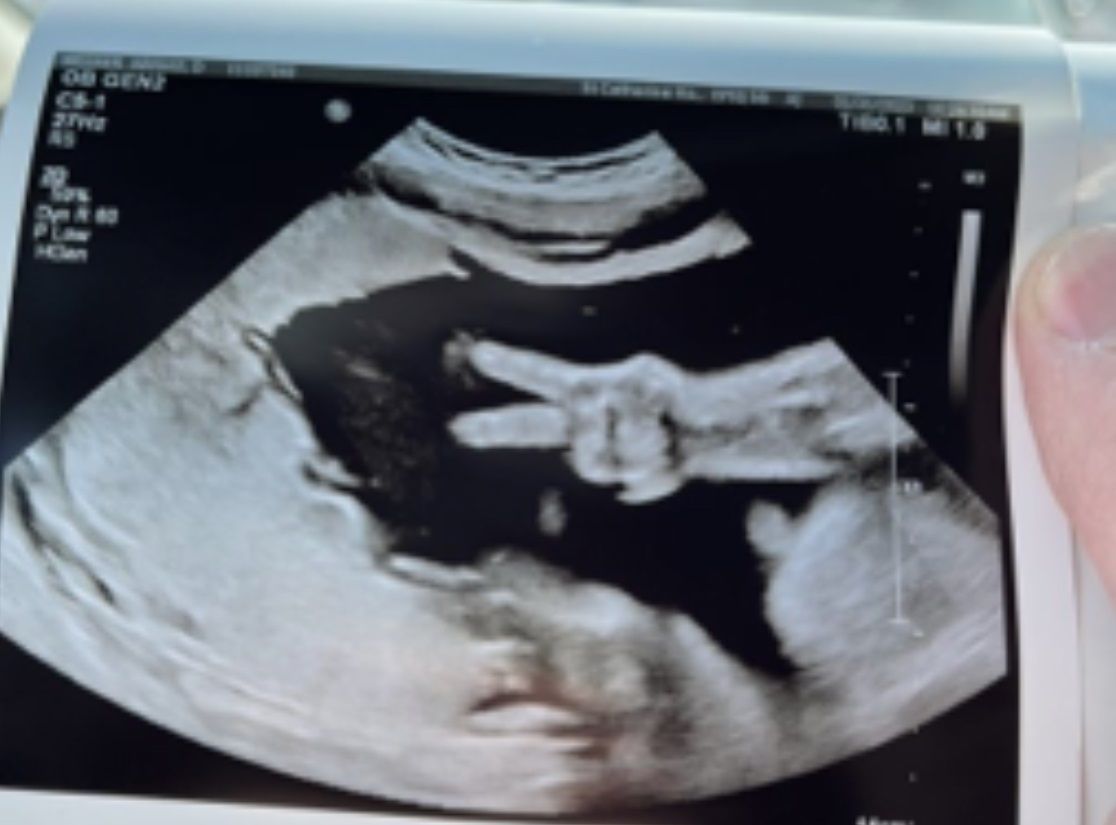 醫生在拍！媽媽產檢「胎兒突然比YA」　奇蹟超音波照曝光 | ETtoda