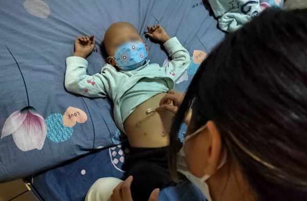 ▲湖南郴州一名3歲女童患上「兒童癌王」之稱的神經母細胞瘤。（圖／翻攝微公益平台）