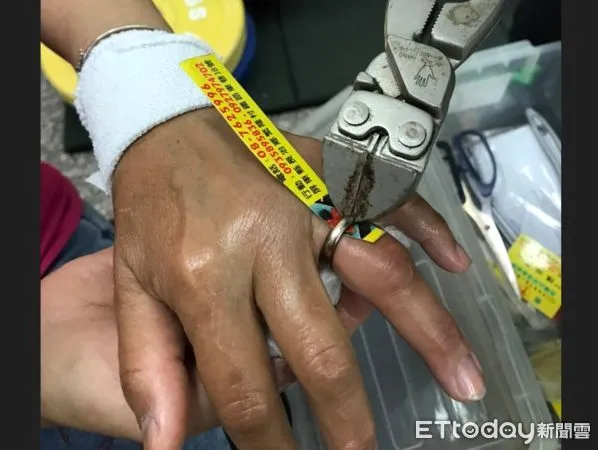 ▲消防人員利用斜口鉗破壞，取出戒指，解除女子疼痛             。（圖／民眾提供，下同）