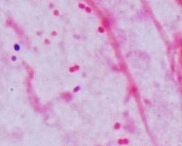 ▲▼革蘭氏陰性鮑氏不動桿菌 顯微鏡下照片。（圖／部立台北醫院提供）