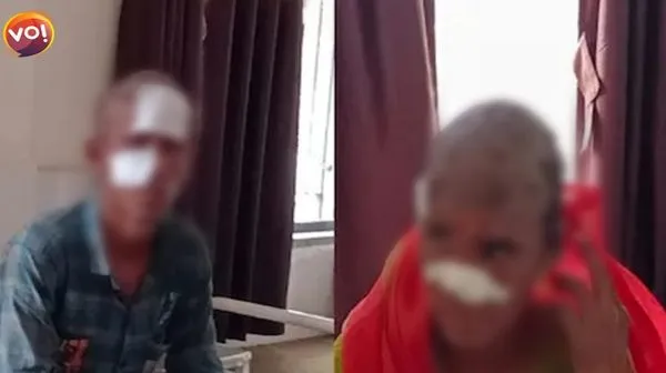 ▲▼人妻出軌尪表弟！私奔被抓回　遭公婆「鐵棍燒下體」割掉耳鼻。（圖／翻攝自Vibes of India）