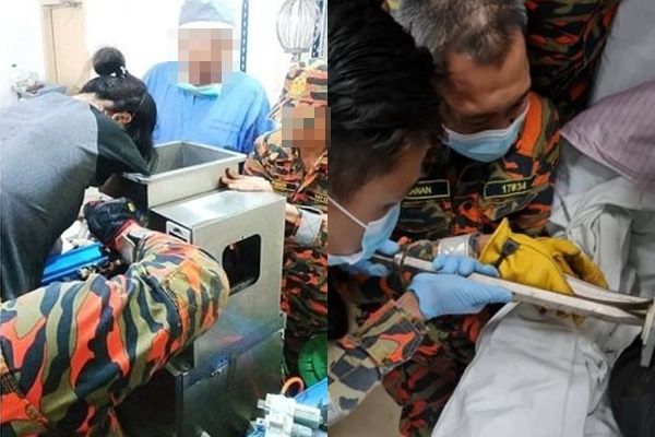 ▲▼馬來西亞一名蛋糕店員工3日意外在操作機器時，將右手捲入揉麵機，導致手掌整個被絞碎，無法接駁。（圖／翻攝自Facebook）