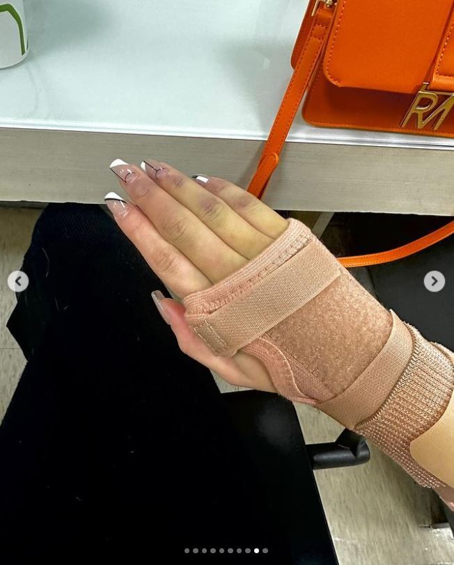 ▲筱崎泫左右手掌都骨裂。（圖／翻攝自Instagram／hsyan0625）