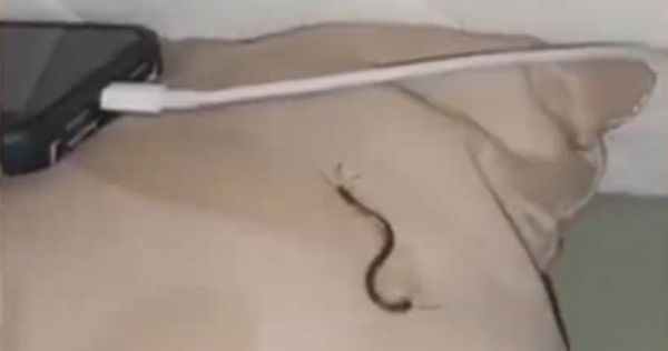 中國一名女子睡覺到一半，被蜈蚣咬傷。（圖／翻攝自微博）