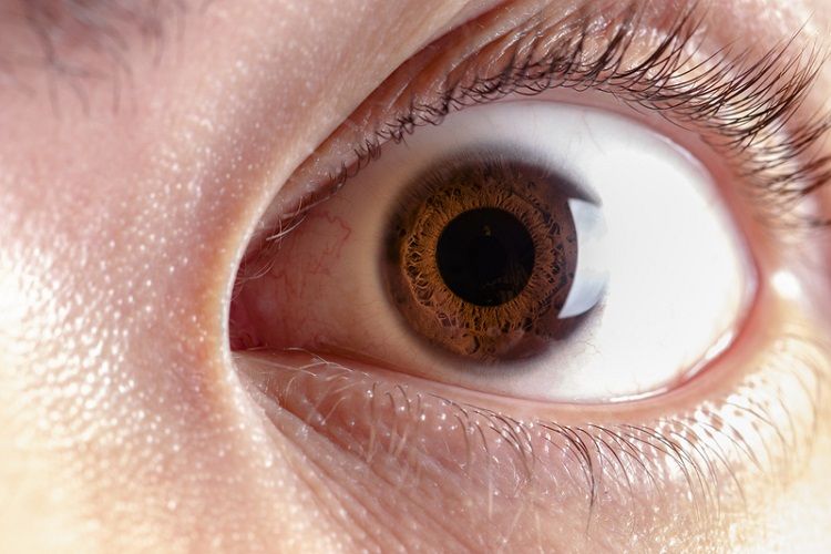 「19種眼睛狀態」看健康！眼袋明顯恐1功能有問題　眼白黃＝肝異常 | E
