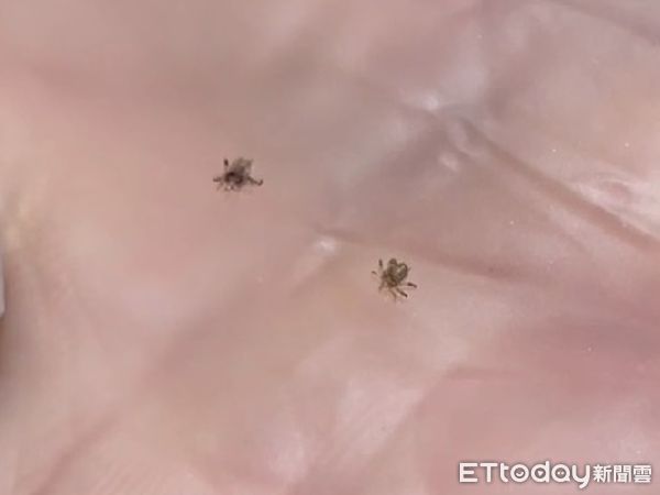 ▲張美玉醫師拍下2隻陰蝨正在爬行的畫面。（圖／記張美玉醫師提供）