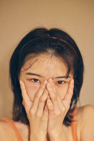 ▲▼女團「BiSH」偶像成員AiNA THE END拍攝中頭部受傷，首發聲公開傷疤。（圖／翻攝自推特／AiNA THE END）