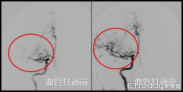 ▲台中派出所副所長上班突癱軟腦中風，警友站長急載人衝院。（圖／亞大醫院提供）