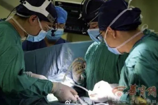 ▲西安交大第一附屬醫院完成大陸首例將微創技術結合心臟不停跳的人工心臟植入手術。（圖／翻攝華商報）