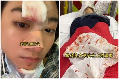 女星暈倒「90度砸下」正臉撞水泥地!血淋淋傷照曝光:撿回一條命