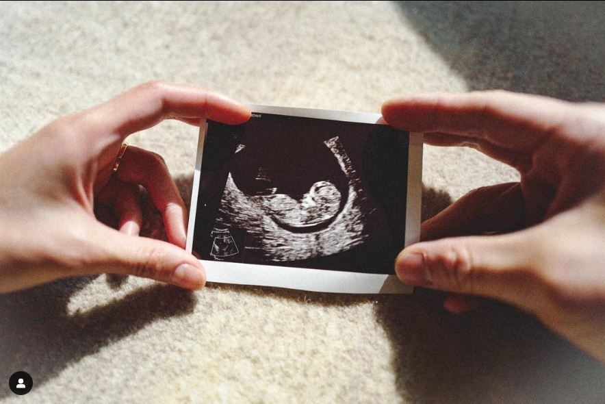 ▲張寶兒宣布懷孕。（圖／翻攝自Instagram／_bowiecheung）