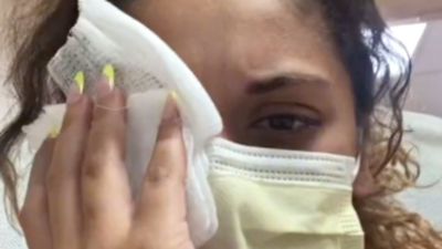 誤把強力膠當眼藥水！22歲女「眼皮死死黏住」醫師決定用金屬器材掰開