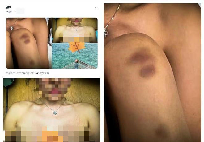 ▲▼中國女生稱在馬爾代夫被酒店管家性侵。（圖／翻攝自極目新聞）
