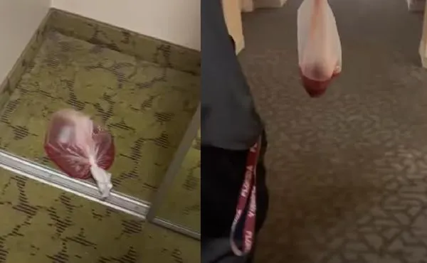 女在飯店房間發現塑膠袋裝「血水胎兒」　畫面瘋傳背後真相曝光。（圖／翻攝自Facebook／Ásh Whïté）