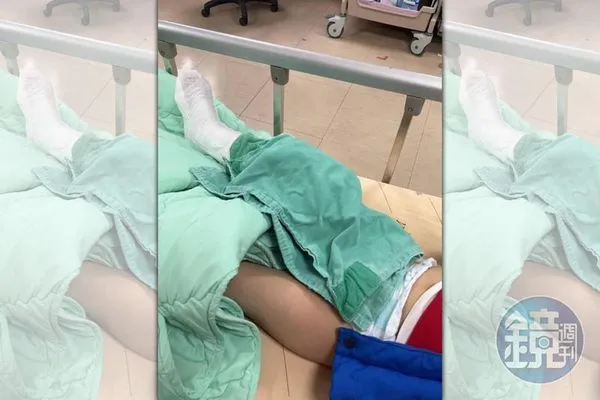 A小姐的小孩於嘉楠風華酒店兒童遊戲區遊玩，疑遭踩踏造成脛骨骨折。（讀者提供）