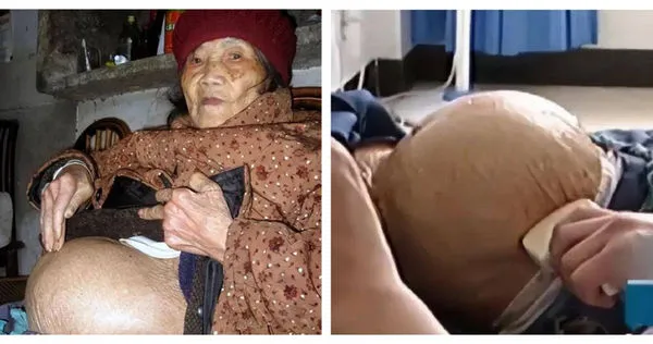 91歲老婦人摔一跤到醫院「查出懷孕」　她摔出深藏60年的秘密