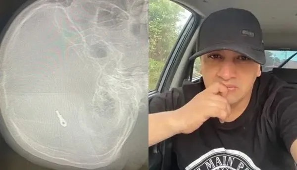 ▲▼卡斯塔尼達在隆鼻手術中被夾子卡進大腦慘死。（組圖／翻攝自YouTube、推特）