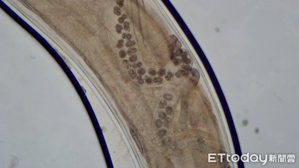 ▲婦人到溪邊玩後狂瀉，求醫後崩潰「白色寄生蟲群狂蠕動、大量產卵」。（圖／亞大附醫提供）