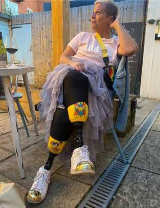 貝絲現在已經學會靠義肢走路。（圖／翻攝自gofundme）