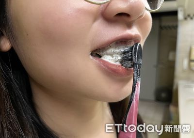 80%台人中招！他天天刷牙也難逃　醫揭「2大錯誤」牙周病不可逆