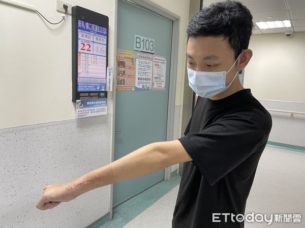 ▲24歲男患罕見「骨巨細胞瘤第三期」，手無力就醫照X光：骨頭被癌細胞吃空。（圖／烏日林新醫院提供）