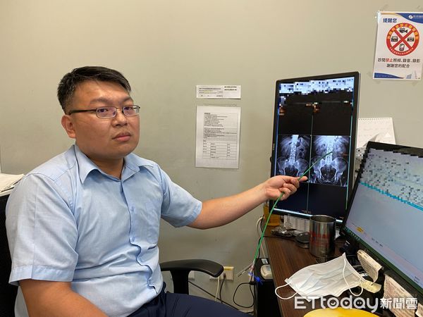 ▲跑步就血尿！男子腎結石沒追蹤竟成8.4公分巨無霸鹿角石，醫：再拖恐洗腎。（圖／長安醫院提供）