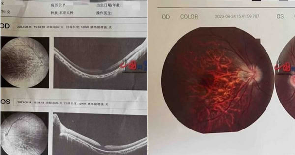 陸女側躺滑手機突「暫時失明」　就醫遭告知1部位病變：症狀不可逆