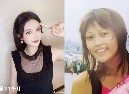 ▲吳曉辰14歲開始整形。（圖／翻攝自微博）