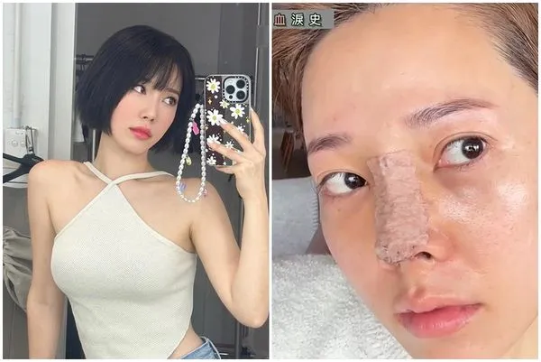 ▲Sue Chang分享兩次整鼻失敗的血淚史。（圖／翻攝自YouTube／suechangg）