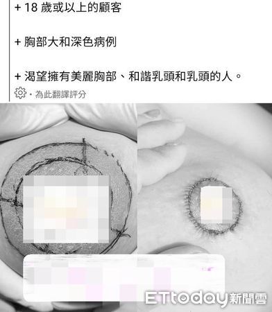 ▲越南籍阮姓女子私設私人美容工作室，幫外籍女移工進行美容醫療手術，專前隊查出阮女透過臉書招攬縮乳暈手術。（圖／記者沈繼昌翻攝）