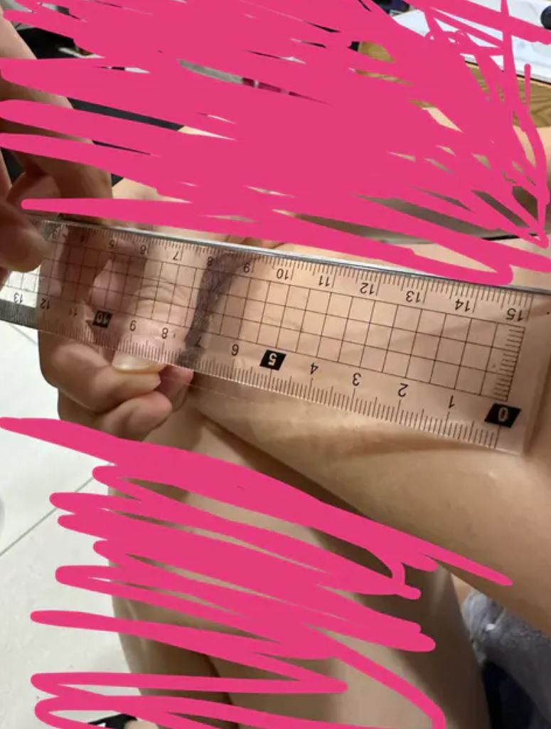 ▲▼毛被拔了。（圖／翻攝自Dcard）