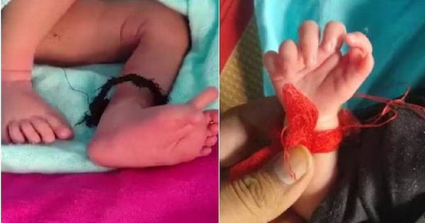 女嬰共有26根手腳指。（圖／翻攝自推特）