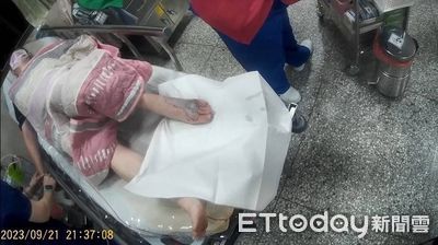 男泡湯左腳被蛇咬1口！拍下牠長相自救　傷口變「麵龜」驚悚畫面曝