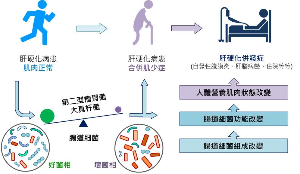 北榮研究發現改變腸道細菌可減少肝硬化合併肌少症及併發症。（圖／北榮提供）