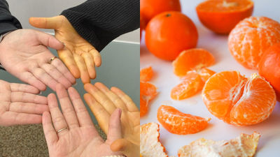 朋友超愛吃橘子！每逢冬天都變「橘色調皮膚」化身辛普森　網樂：太好吃了