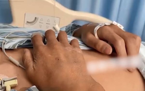 ▲▼除草劑當飲料喝「不敢告訴爸媽」　14歲少年從嘴到胃全腐蝕。（圖／翻攝自微博）