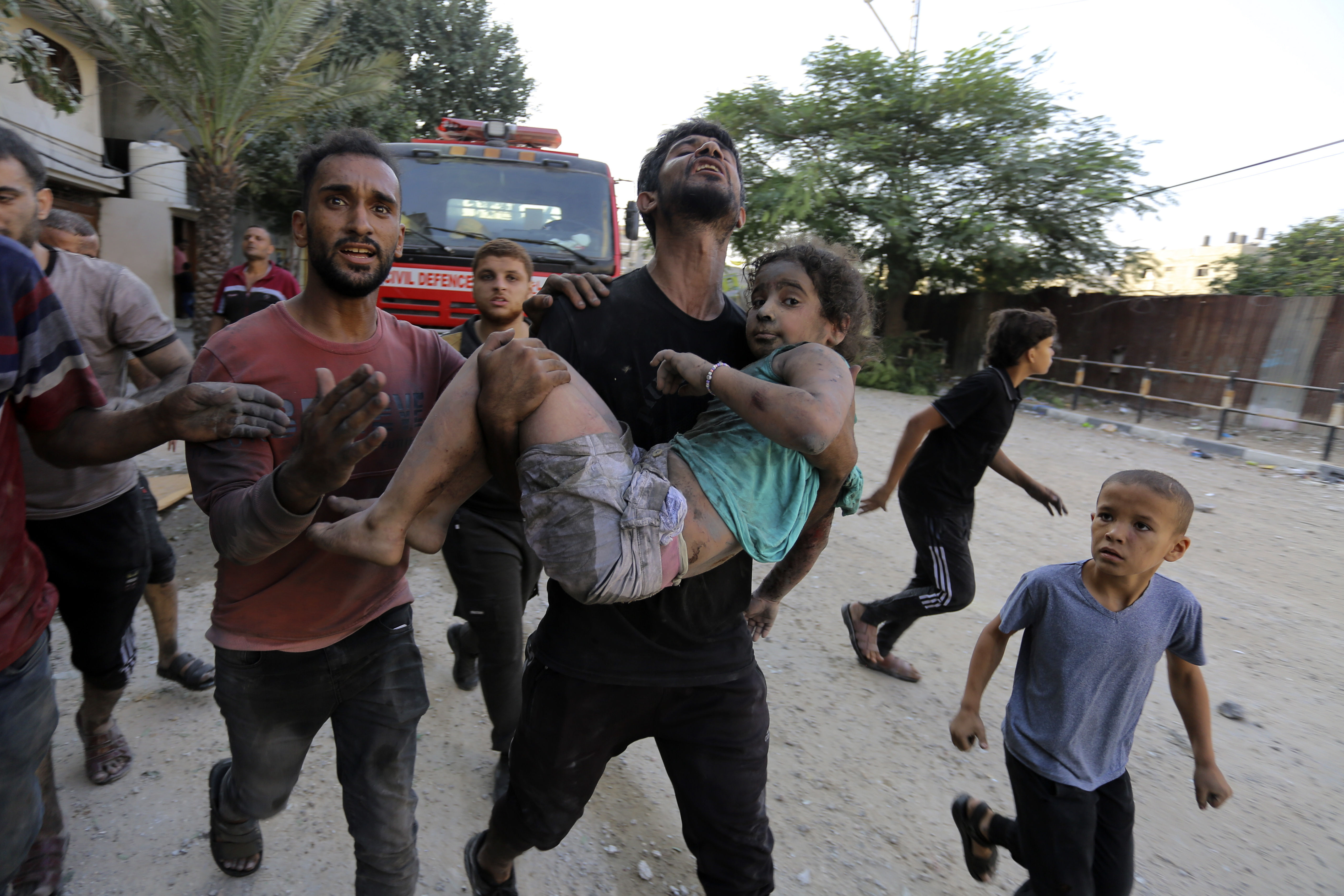 ▲▼ 巴勒斯坦男子抱著受傷的女孩。（圖／達志影像／美聯社）