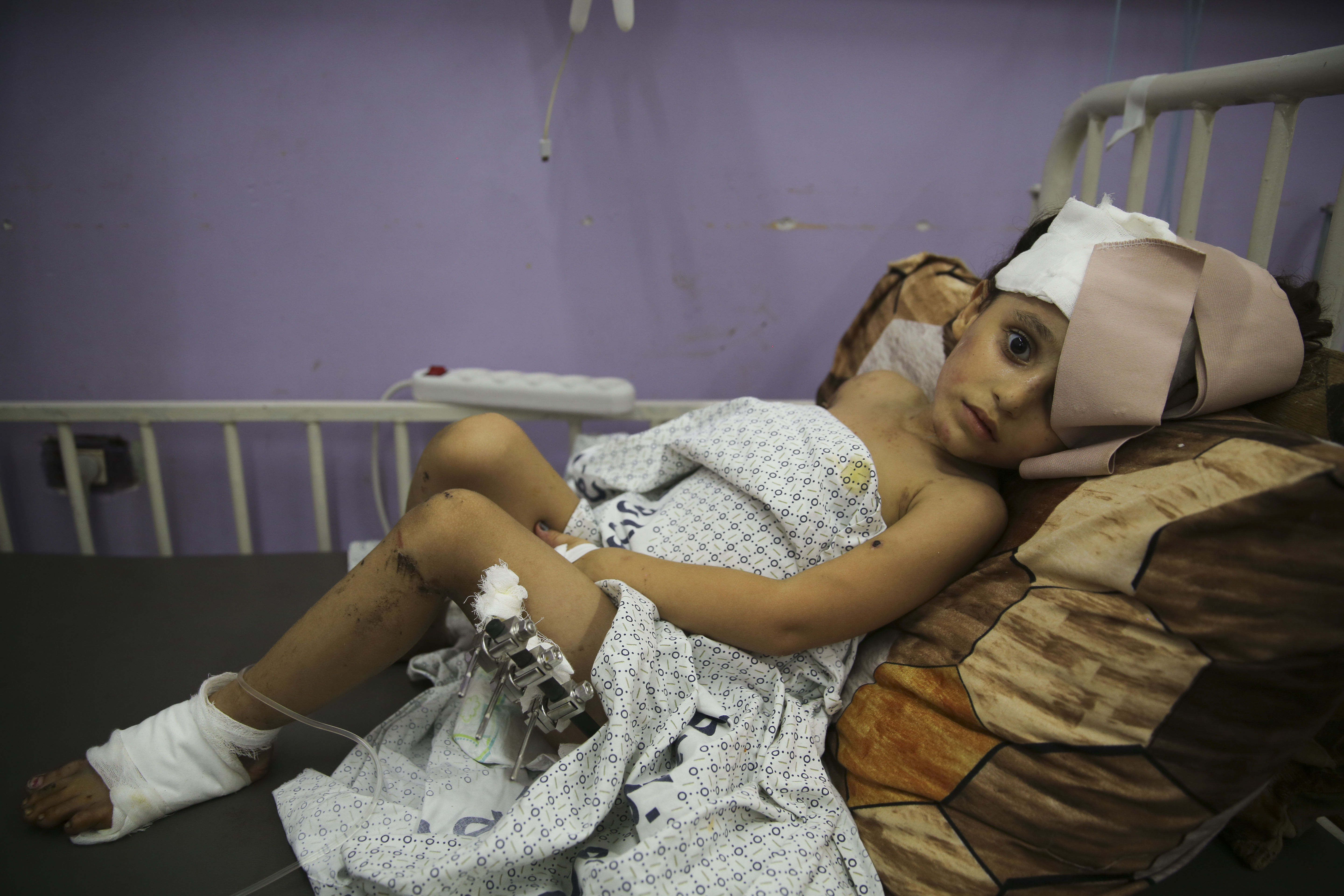 ▲▼ 加薩連日遭以色列，醫院湧入大量傷患。（圖／達志影像／美聯社）