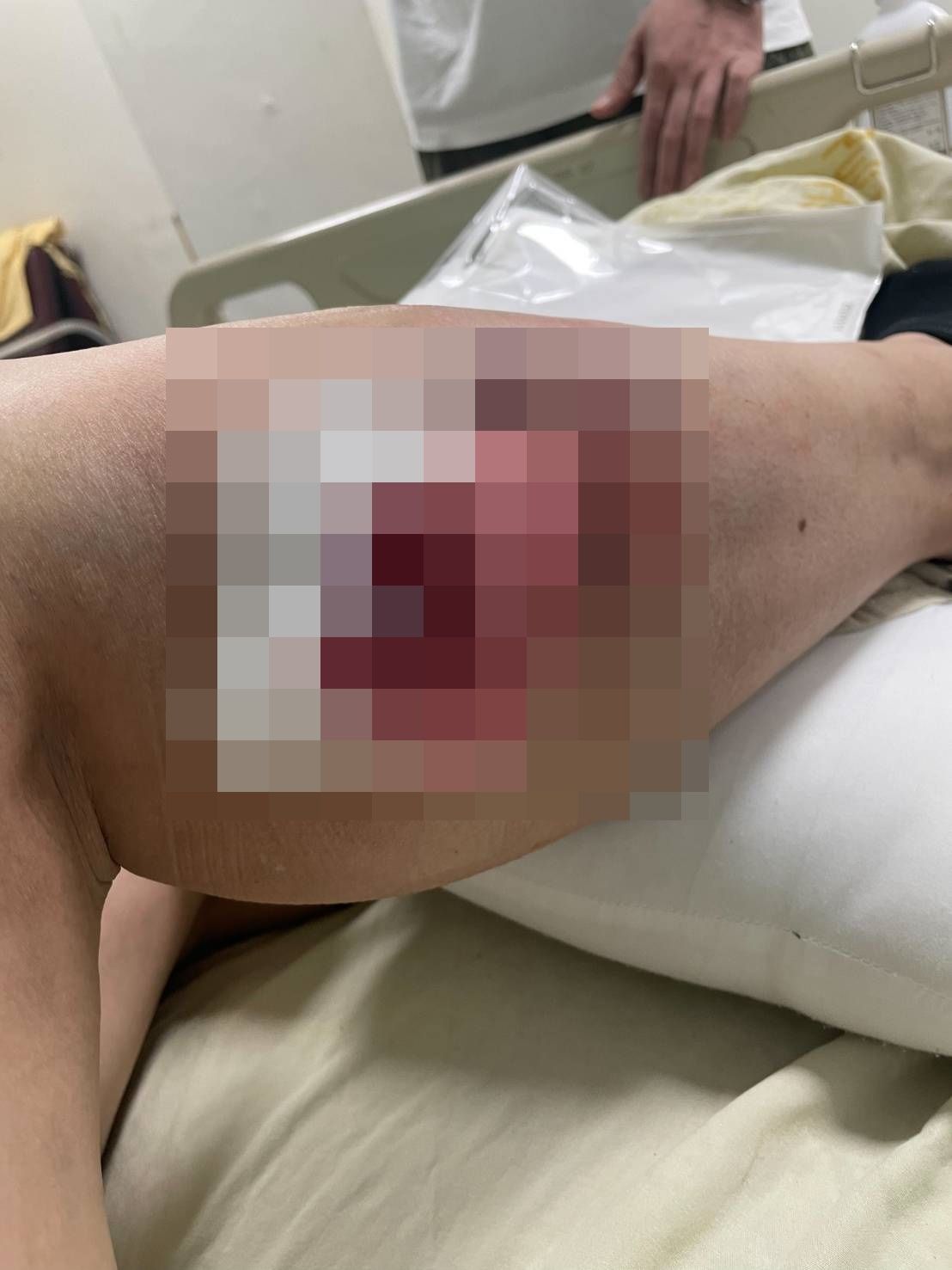 ▲▼狼犬發狠攻擊路人，阿嬤手腳遭撕咬，鮮血直流，還好孫子沒受傷。（圖／民眾提供，下同）