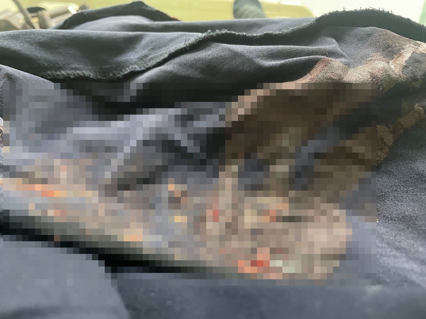 ▲▼狼犬發狠攻擊路人，阿嬤手腳遭撕咬，鮮血直流，還好孫子沒受傷。（圖／民眾提供，下同）