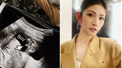 李千娜懷胎4月「一直頭暈想吐怎辦」！醫給12字解答  她傻住：ㄛ⋯