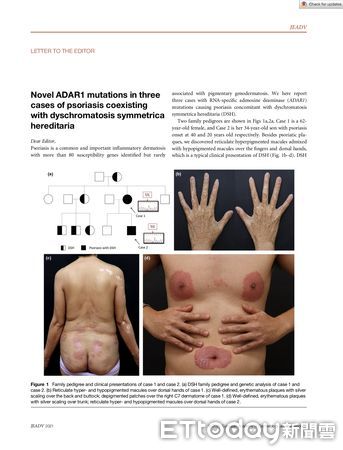 ▲▼國際乾癬醫學會理事長Hervé Bachelez於花蓮慈院分享他對乾癬精準治療的展望與最新研究。（圖／慈濟醫學中心提供，下同）