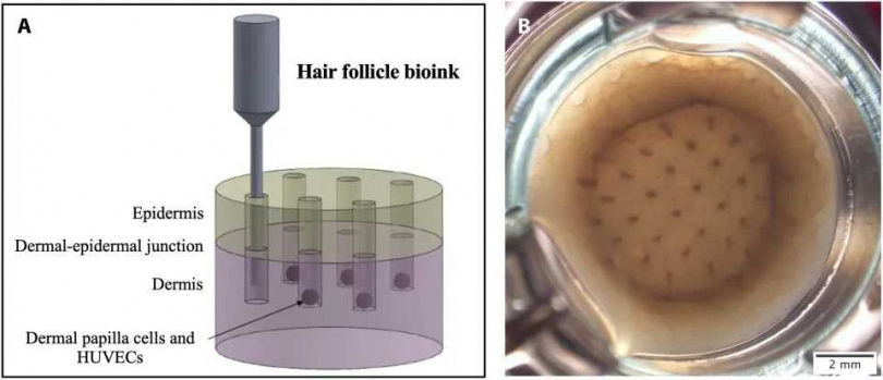 治癒禿頭的希望來了　科學家用3D列印技術讓人類毛囊細胞生長